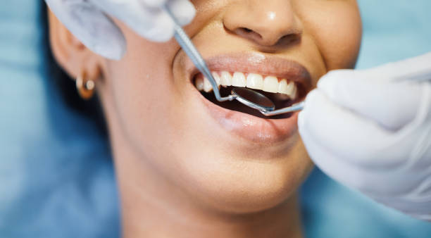 Best Emergency Dental Care for Broken or Chipped Teeth in Lake City, PA